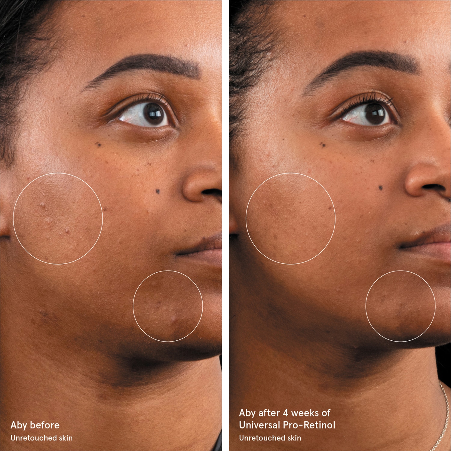 UNIVERSAL PRO-RETINOL OVERNIGHT RENEWING TREATMENT (TRATAMIENTO RENOVADOR DE NOCHE)